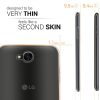 Кейс за LG X Power 2, Силиконов, Прозрачен, 41194.03