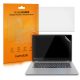 Комплект от 2 защитни фолиа за камера Kwmobile за Lenovo Yoga 530 (14"), прозрачно, пластмасово, 51149.2